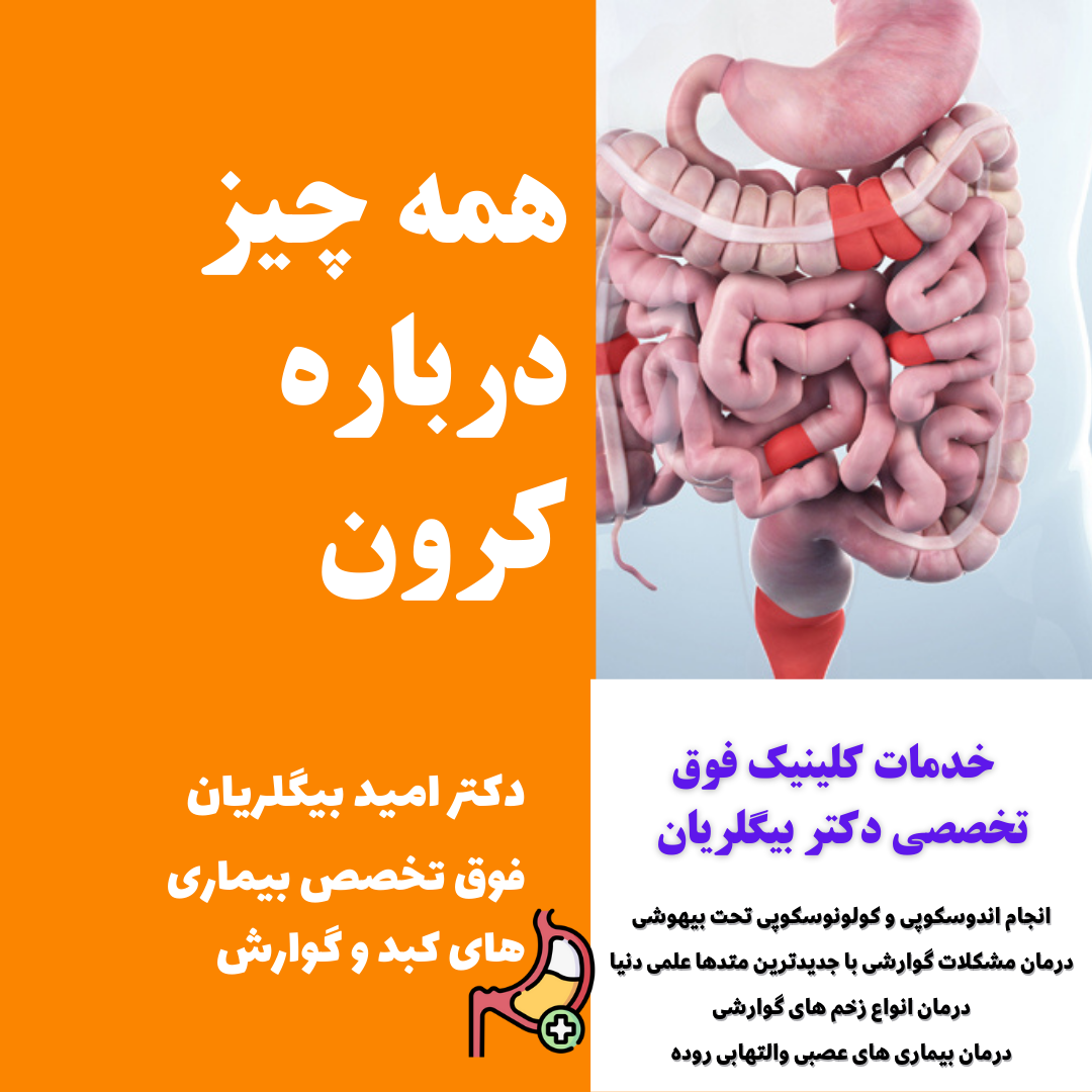 بیماری کرون