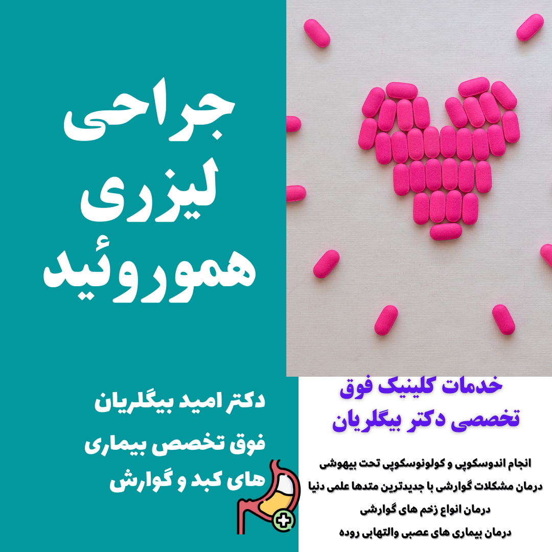 جراحی لیزری هموروئید با بیهوشی