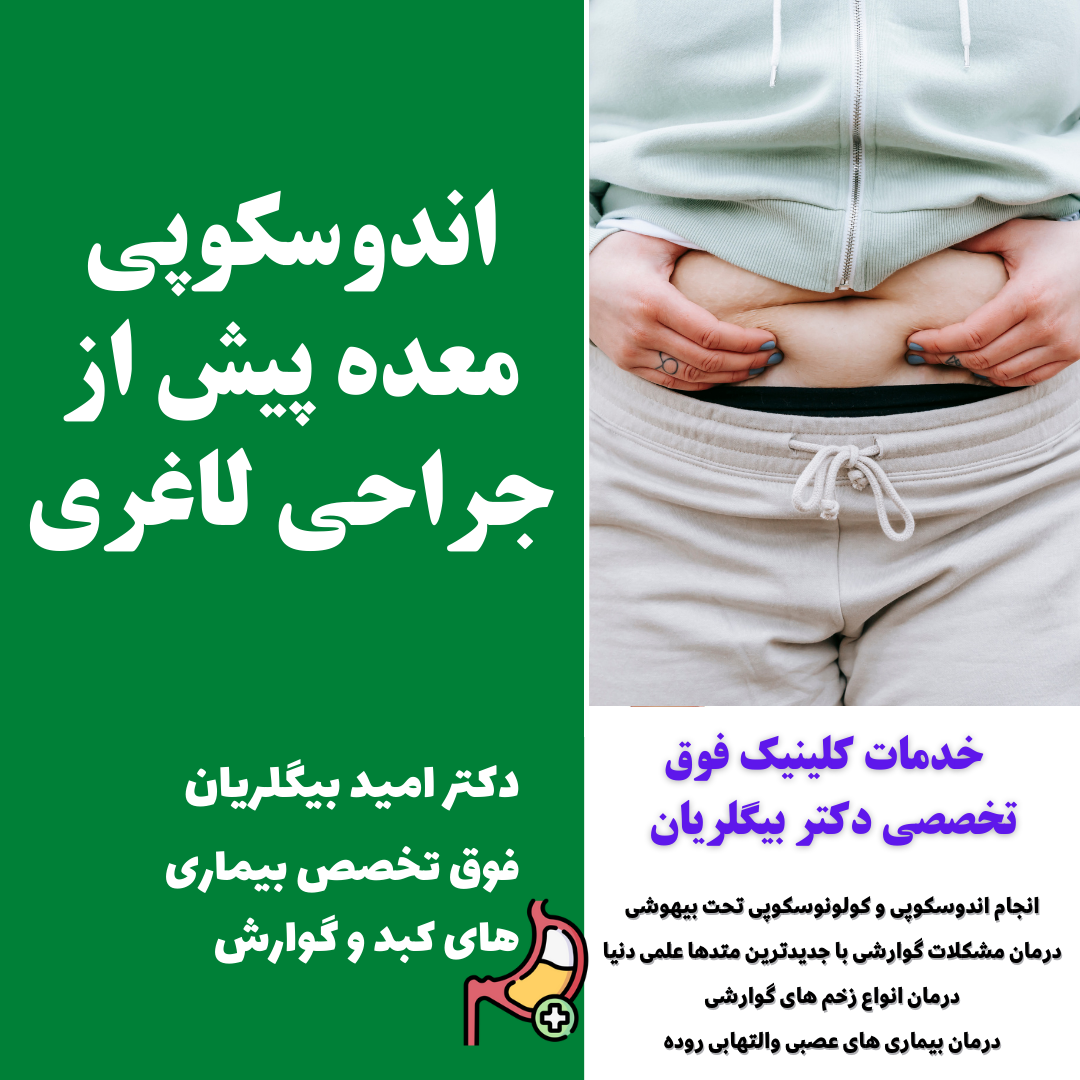 اندوسکوپی معده برای جراحی اسلیو