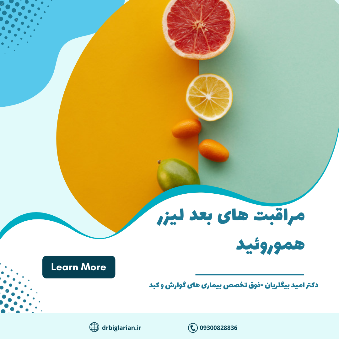 مراقبت های بعد از لیزر هموروئید در کرج