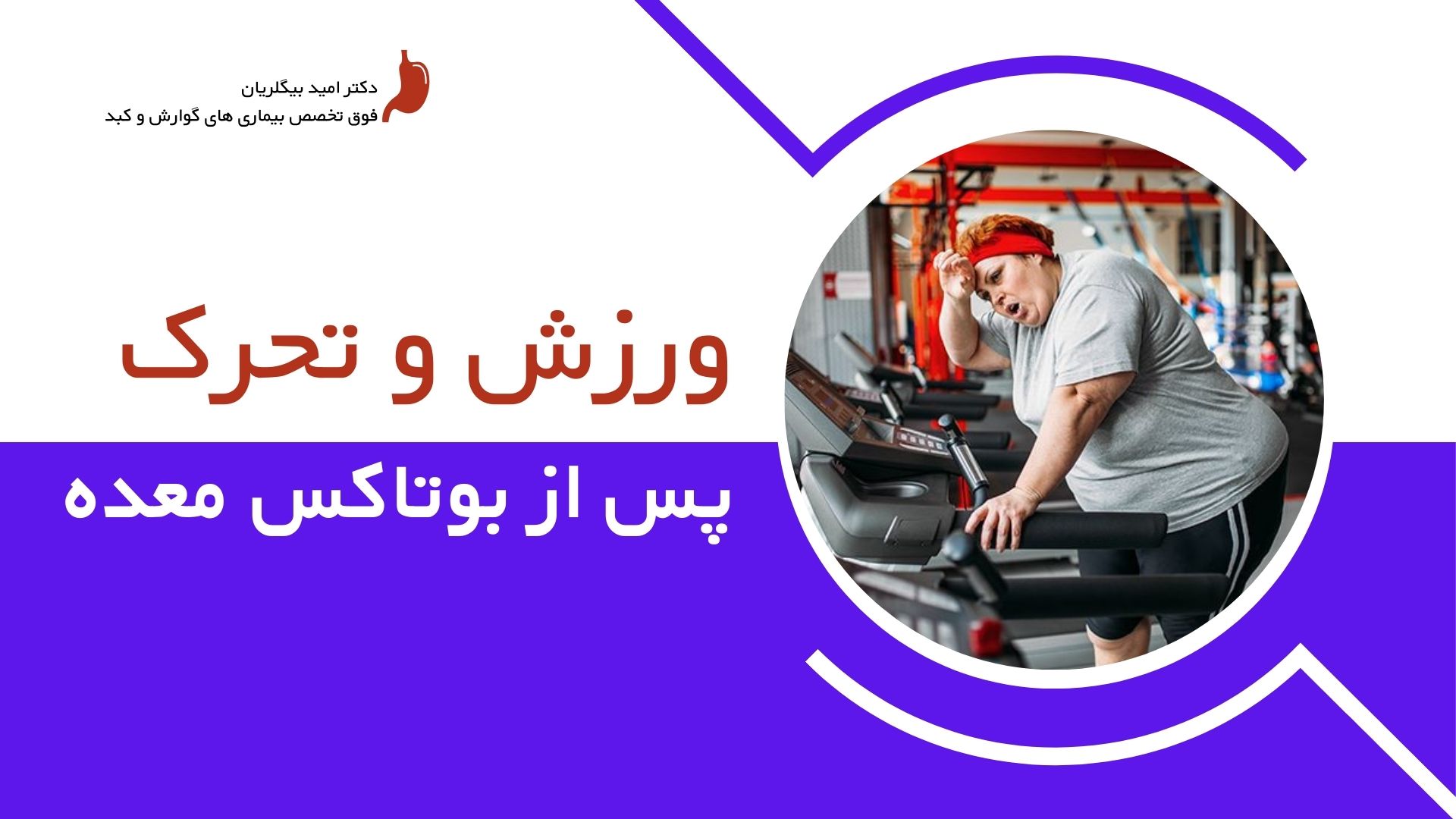 بهترین ورزش پس از بوتاکس معده