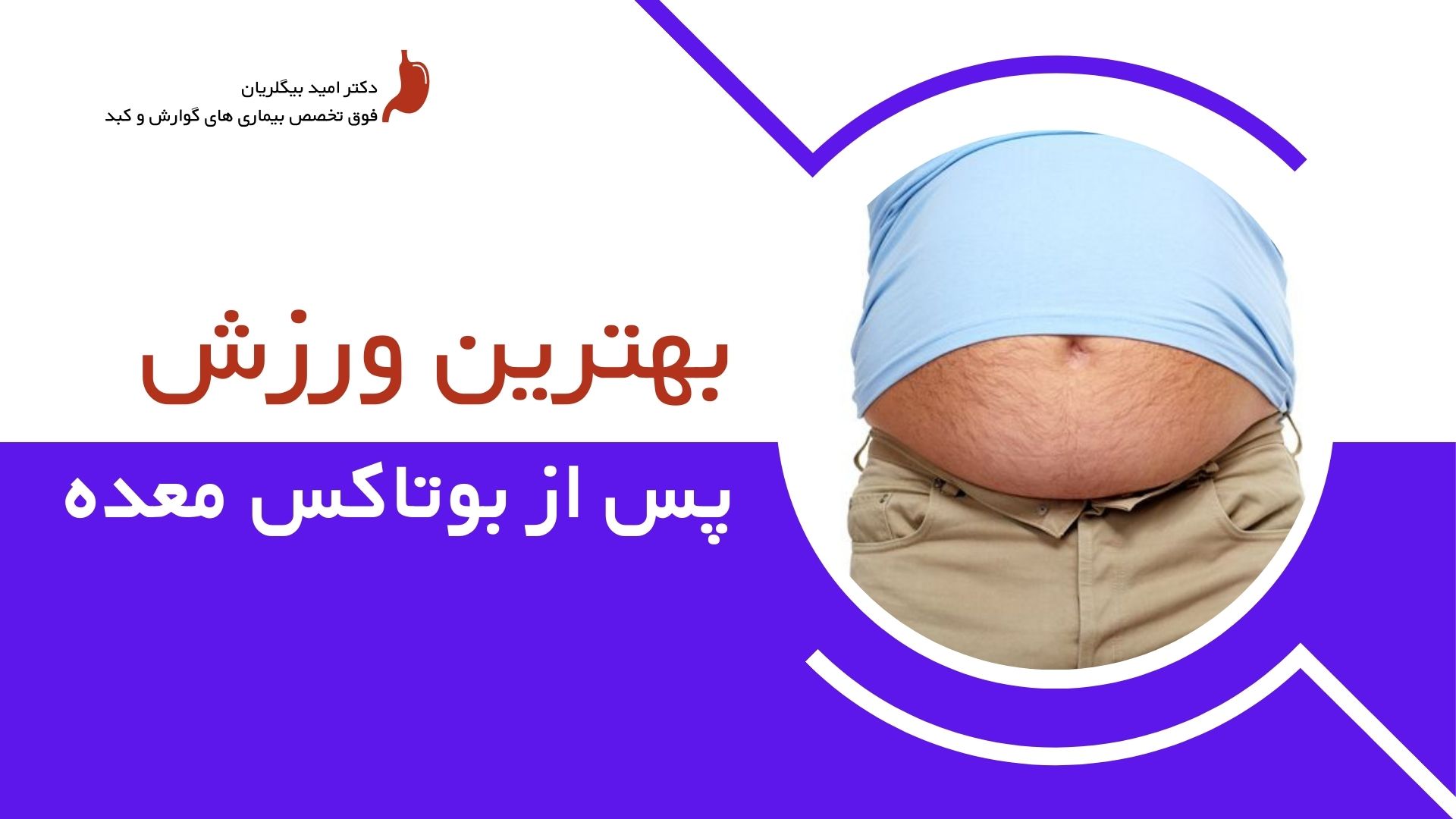 بهترین ورزش های پس از بوتاکس معده