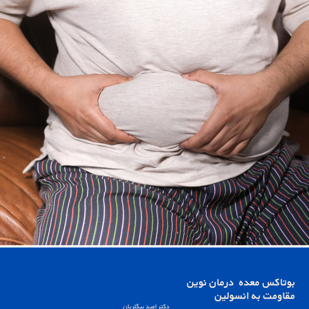 بوتاکس معده برای درمان مفاومت به انسولین