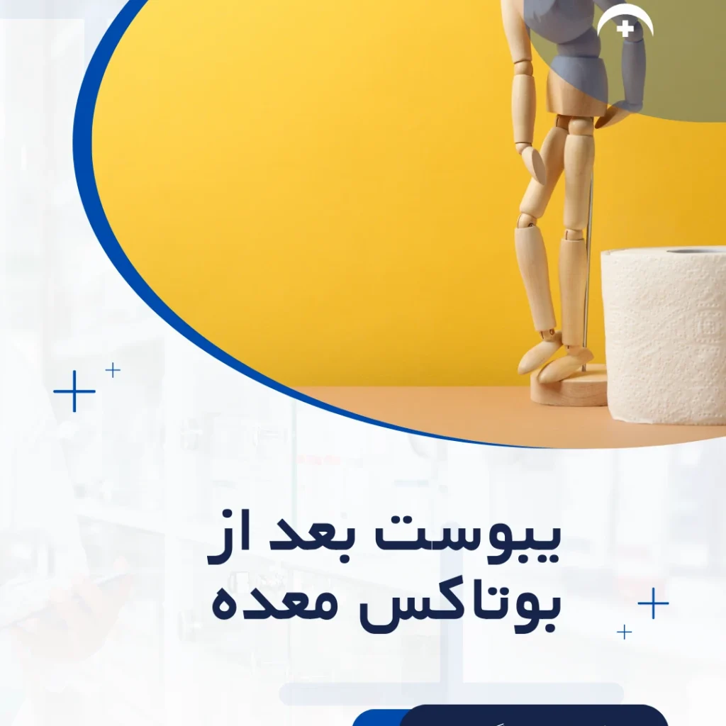 درمان یبوست بعد از بوتاکس معده