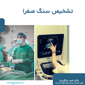 تشخیص سنگ صفرا