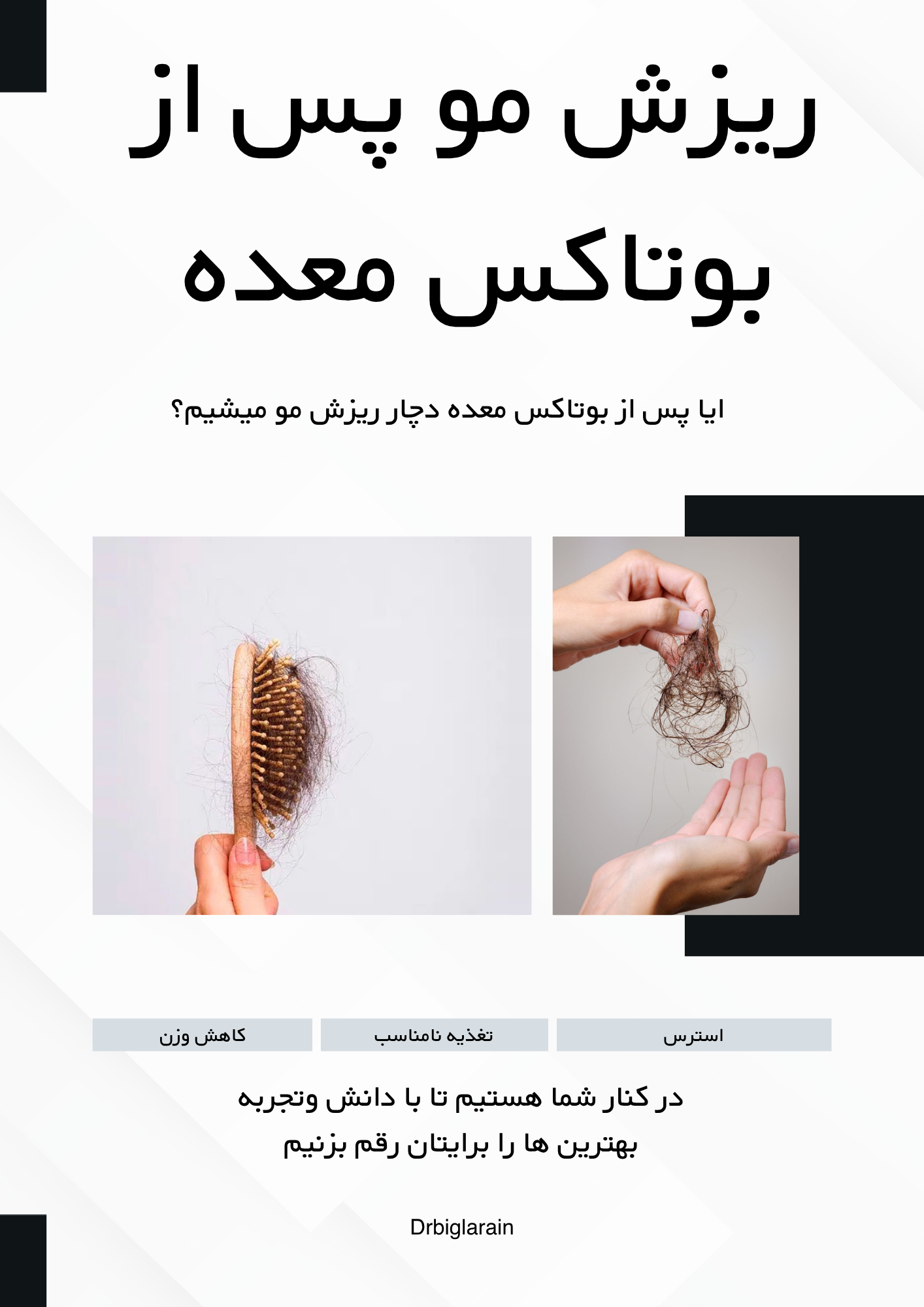 ریزش مو پس از بوتاکس معده