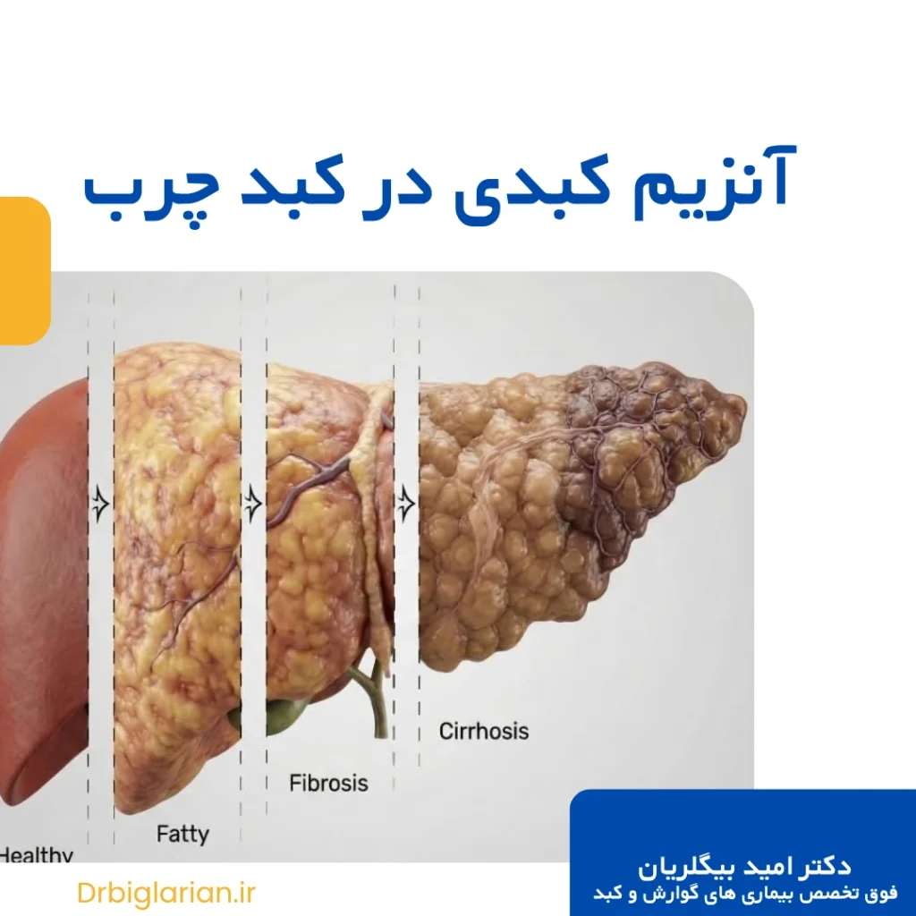 آنزیم کبدی نرمال در کبد چرب