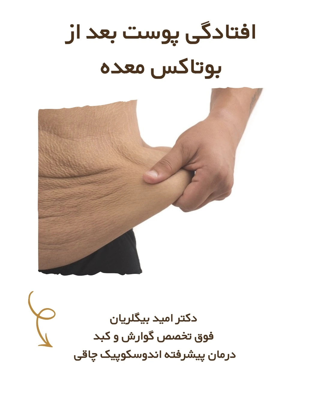 افتادگی پوست بعد از انجام بوتاکس معده